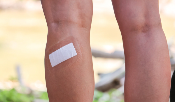Why Do I Have to Stop Exercising After a Skin Lesion is Removed?